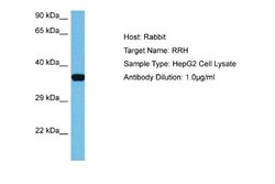 Peropsin Rabbit anti-Human, Polyclonal, Novus Biologicals 0.1ml; Unconjugated:Antibodies,